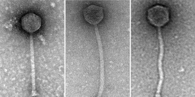 Phage therapy treats patient with drug-resistant mycobacterial infection